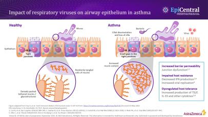 The bronchial epithelial immune response to multiple triggers